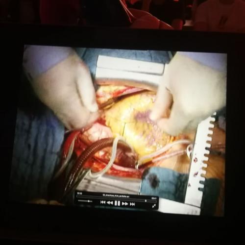 Ein Blick ins Herz – Was ein Chirurg täglich erlebt