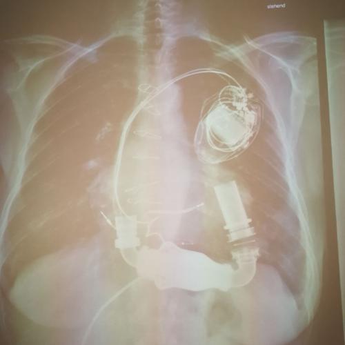 Ein Blick ins Herz – Was ein Chirurg täglich erlebt